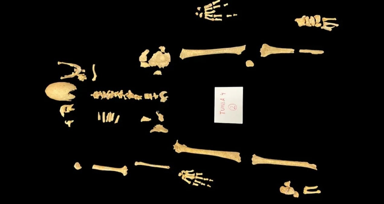 Uzun ve dar kafatası bulunan iskelet ortalığı karıştırdı